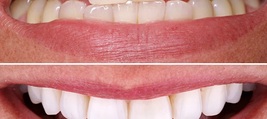 FIXT Dental