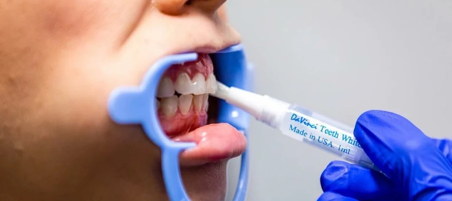 Flawless Teeth Whitening