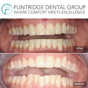 Flintridge Dental Group