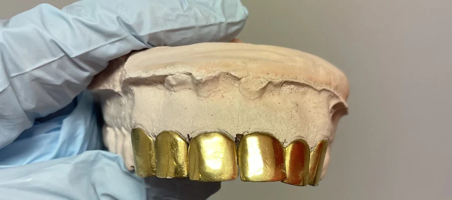 Gold Teeth and Gems of LA