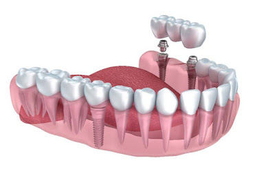 Havens Family Dental