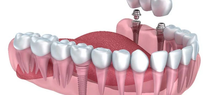 Havens Family Dental
