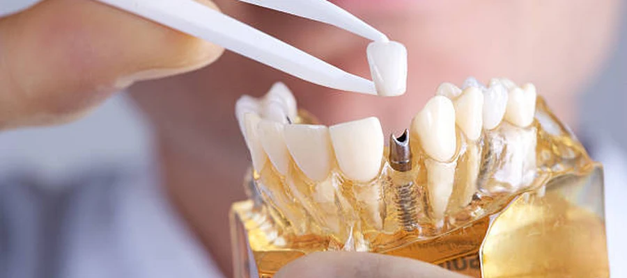 Heinle Dental
