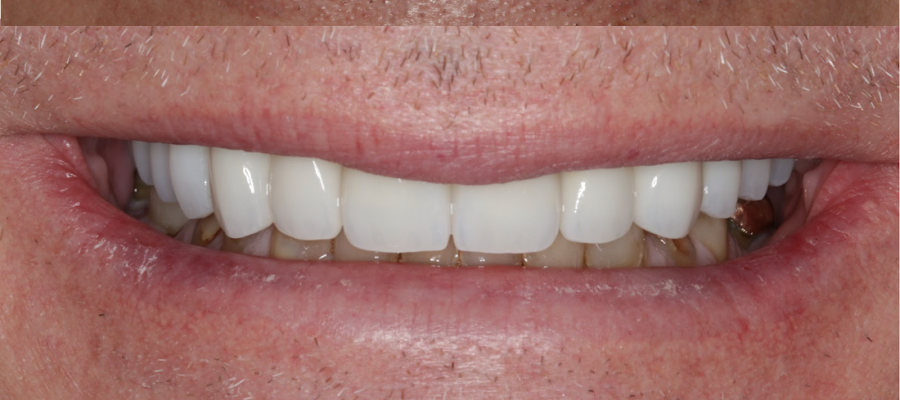 Hometown Smiles Dentistry