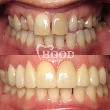 Hood Dental Care - Denham Springs