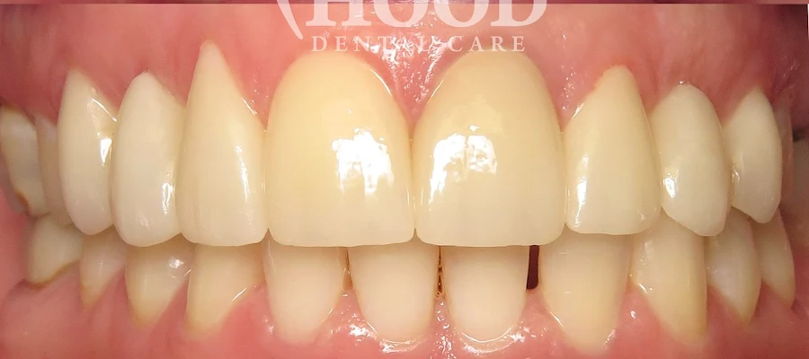 Hood Dental Care - Watson Office
