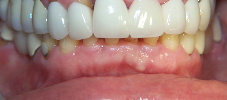 implantasmile.com