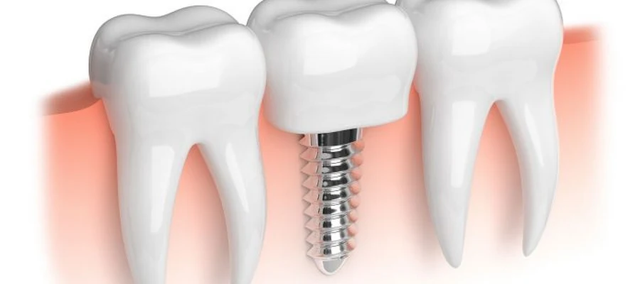 Island Dental