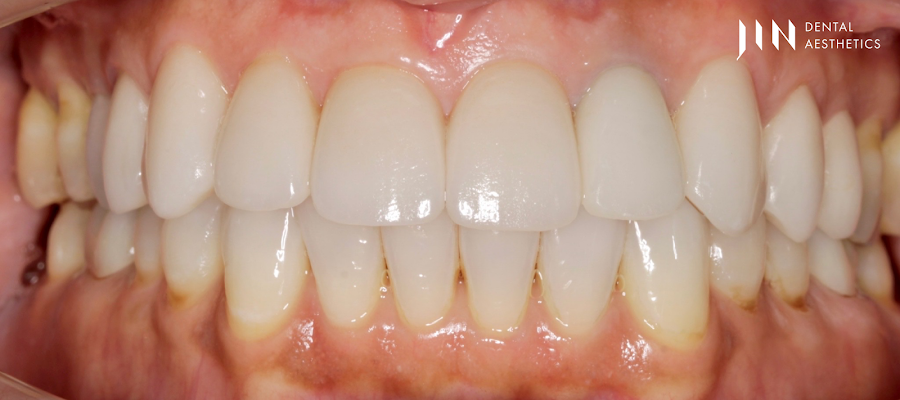 Jin Dental Aesthetics