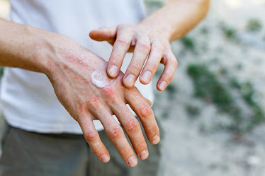 KVH Dermatology