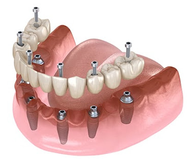 La Costa Family Dental and Implant Center
