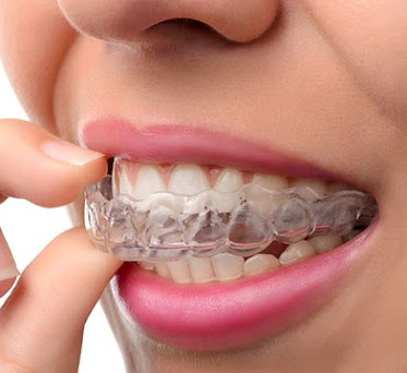 Lake Country Dental