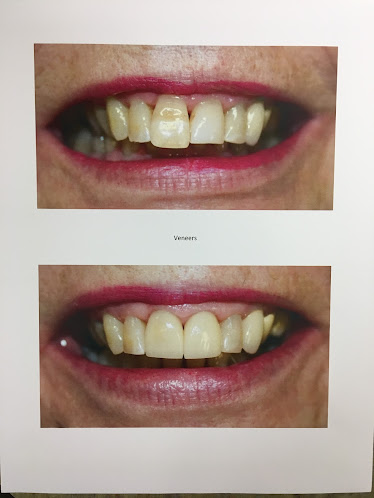 Lake Harris Dental