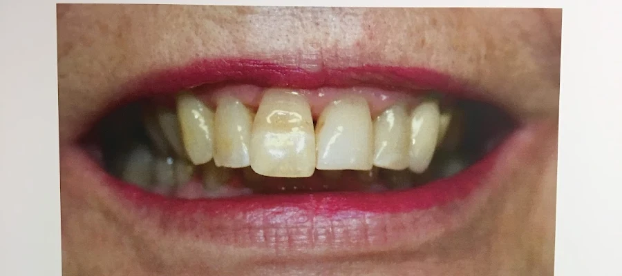 Lake Harris Dental
