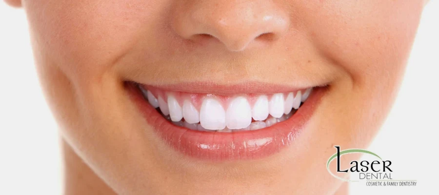 Laser Dental