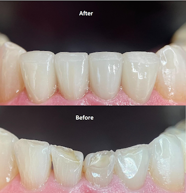 Laurel Smiles Dental Care