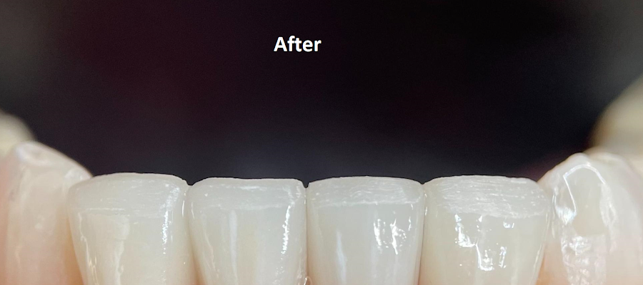 Laurel Smiles Dental Care