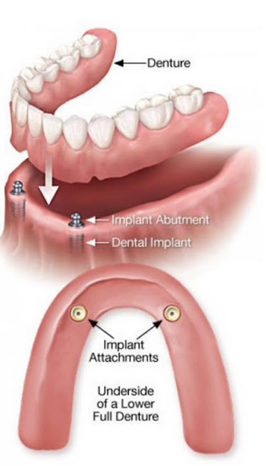 LAX DENTAL & ORTHODONTICS