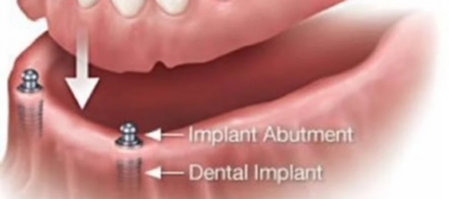 LAX DENTAL & ORTHODONTICS