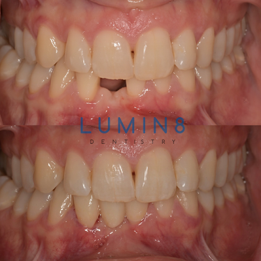 Lumin8 Dentistry