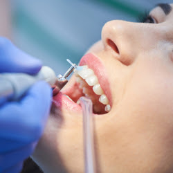 Madison Family Dental Associates - Madison