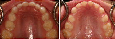 Medford Dentist - Dr. Nathan Tanner DMD