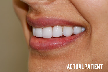 Menlo Park Family Dental
