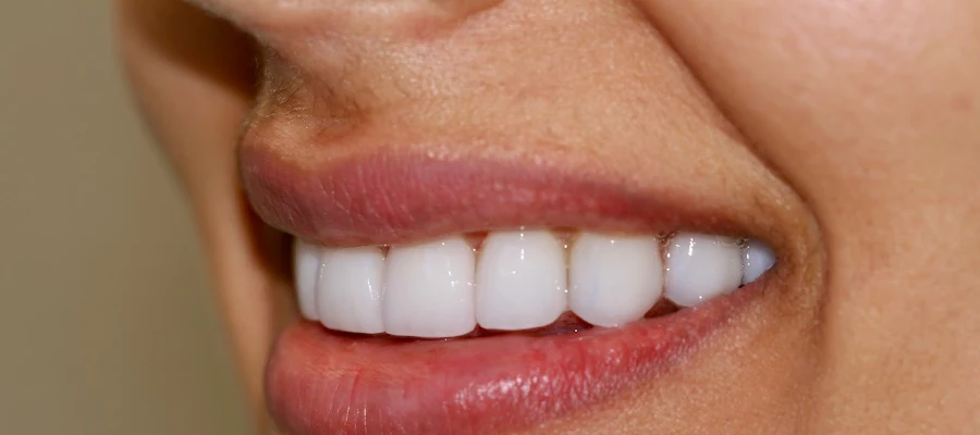 Menlo Park Family Dental