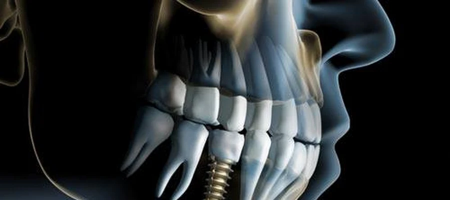 Metro West Dental & Implant Institute