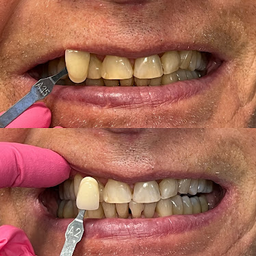Miami Beach Dental Solutions