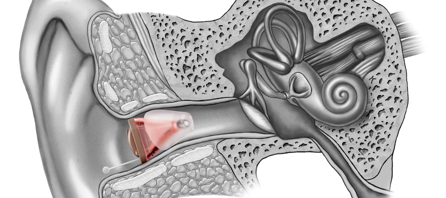 Midland Hearing Associates, A Division of Hear Again America