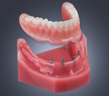 Mini Dental Implant Centers of America - Colorado Springs, CO