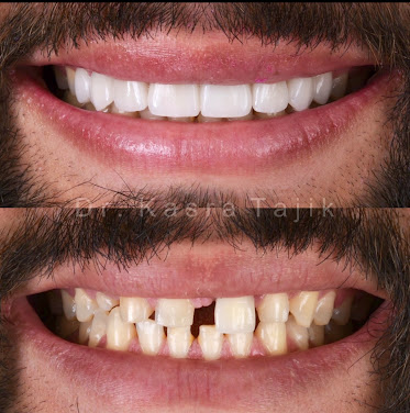 Modern Smiles