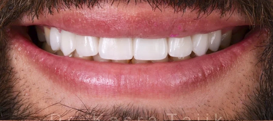 Modern Smiles