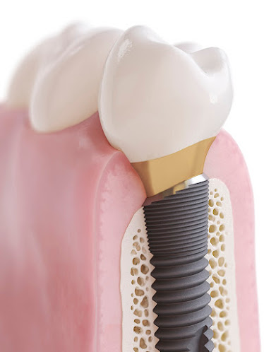 Mountain Park Dentistry,LLC