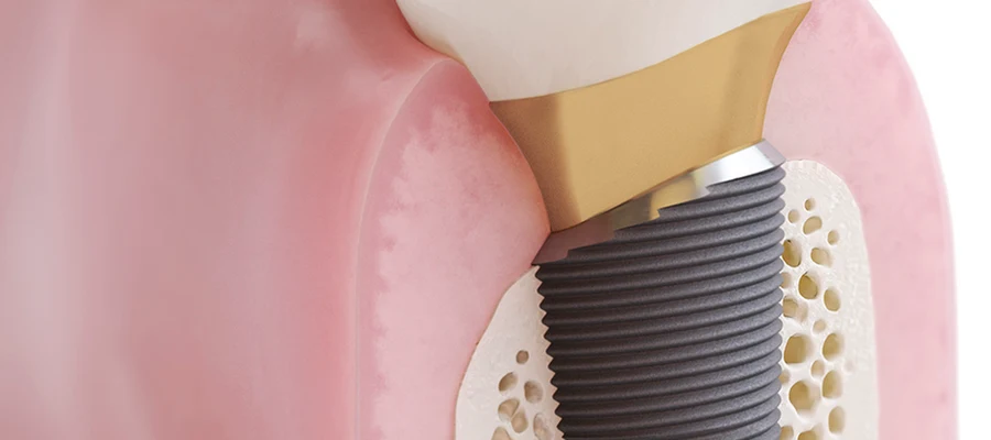 Mountain Park Dentistry,LLC