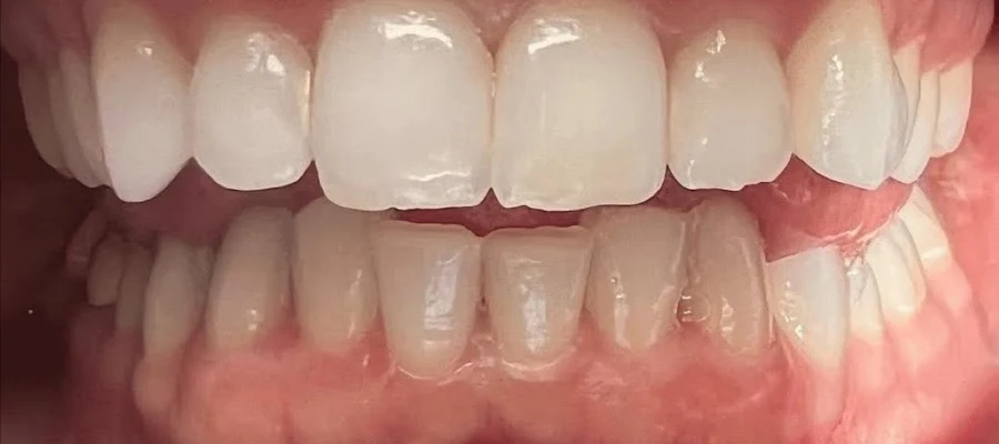 Mountain Ridge Dental