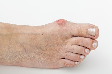 New Mexico Foot & Ankle Institute Albuquerque