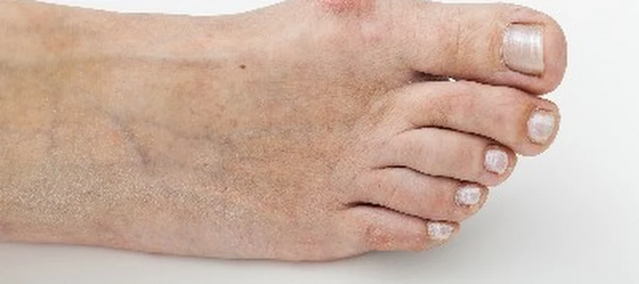 New Mexico Foot & Ankle Institute Albuquerque