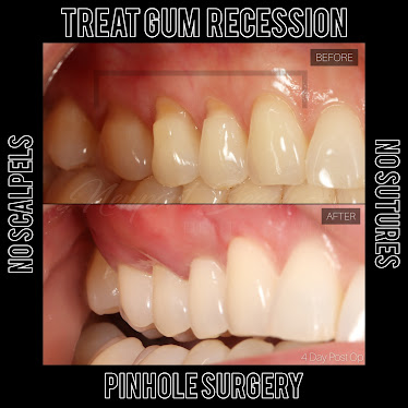 Newport Beach Dental Studio | Dr. Tai Ha, DDS