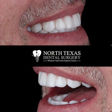 North Texas Dental Surgery