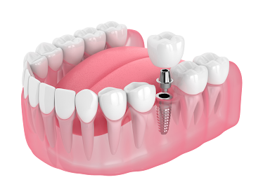 Norwalk Dentistry & Implants