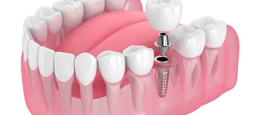 Norwalk Dentistry & Implants