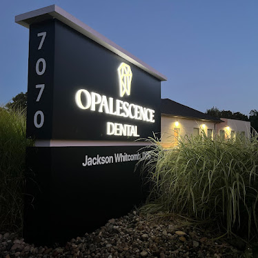 Opalescence Dental