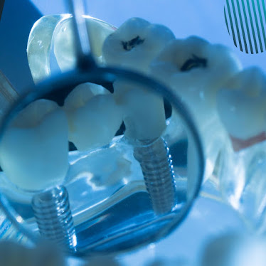 Oral and Maxillofacial Surgeons of Northern Arizona