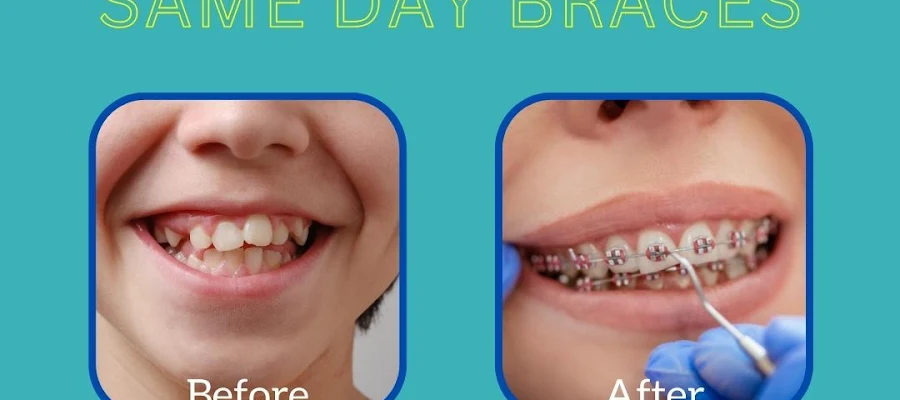 Orthodontic Specialists of Florida