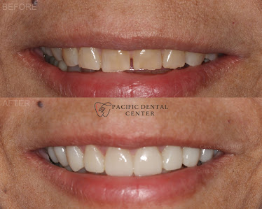 Pacific Dental Center of Lacey