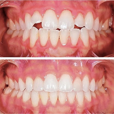 Pantego Dental and Orthodontics