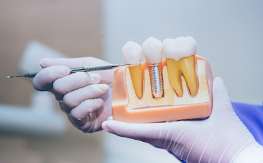Parkway Family Dental