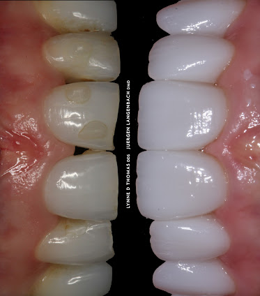 Pearls of Dentistry